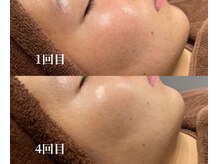 オアシス 岡崎(Oasis)/フェイシャルサロンOasis岡崎