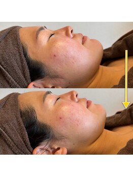 ベラノーブル(bella noble)/キメが整う素肌美人さん