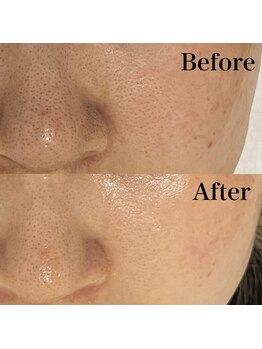 リレイスフクオカ(RelaceFUKUOKA)/セラピール