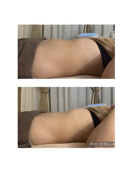 アンドゥ 津田沼(Undo)/ぽっこりお腹に！