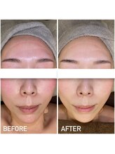 エステプリヴェモロッコ(ESTHE PRIVE MOROCCO)/ILLUSTRIOUS 【赤み・色ムラ】