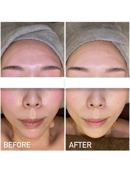 エステプリヴェモロッコ(ESTHE PRIVE MOROCCO)/ILLUSTRIOUS 【赤み・色ムラ】