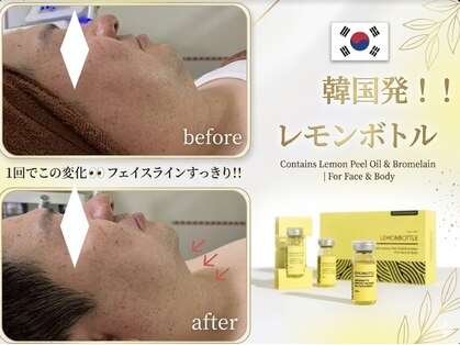 美ネージュの写真