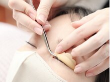 ルーディーアイズ(Loody eyes)/引っ張らない丁寧な手技が自慢