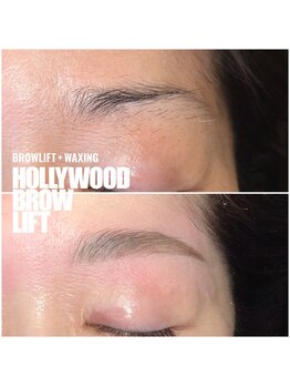 リリフリー(riri Free)/ハリウッドブロウリフト