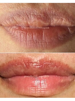 クラティス(CRATIS)/