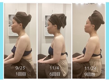 千歳の女神 岡崎店/【施術風景】Before/After