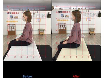 ストレチックス 近江八幡店/BeforeAfter