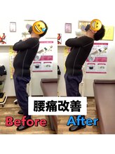 ヒデ整体院(Hide整体院)/猫背矯正骨盤矯正B/A肩こり腰痛