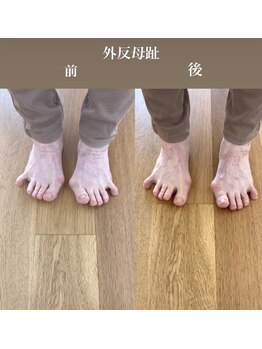 ランドル(rendre)/親指の曲がり