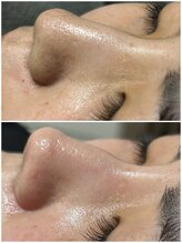 スイ メゾン アトリエ(SUE Maison Atelier)/フェイシャルワックス