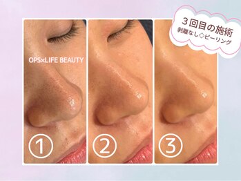 オプス ライフビューティー(OPS×LIFE BEAUTY)/毛穴レスな肌になりたい!!