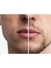 新人男性スタッフデビューメンズ全身脱毛クーポン