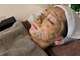 Salon de Lunoaの写真/尼崎でここだけ！肌に負担なく効果実感◎400万本シリカニードルでハリツヤUP♪