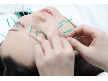 ライフサロン 天神(Life Salon)の写真/美容鍼で小顔効果◎たるんだお顔もキュッとリフトアップし改善！速攻性の高いツボを刺激し肌の質感もＵＰ♪