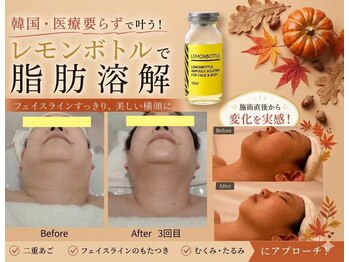 イーズ ミュゼ ららぽーと横浜店の写真/【小顔・毛穴ケア】韓国発脂肪分解レモンボトル3cc×小顔×肌質改善で理想の横顔美人!120分¥16500→¥8800