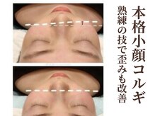 グラシーズ(Glasses)/韓国本格小顔コルギで歪みも◎