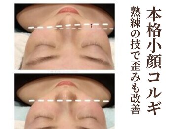 グラシーズ(Glasses)/韓国本格小顔コルギで歪みも◎