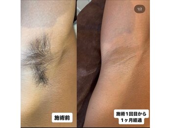 アレッド 大阪店(ared.)/気温が上がり始めました