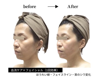 クレビア(CREBIA)の写真