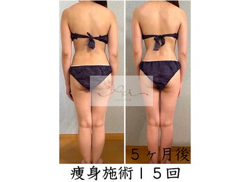 アイ エステサロン(Ai)/こんなに痩せられるなんて♪