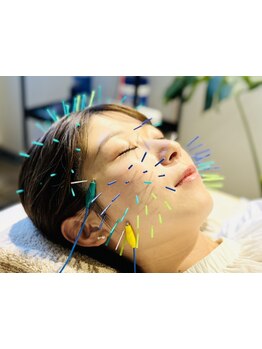 小顔になりたい