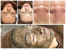 ビューティツリー(beauty tree)