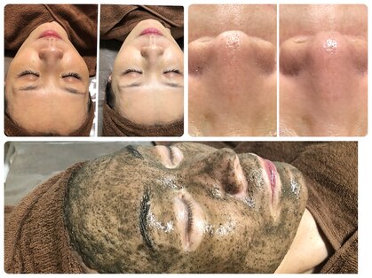 ビューティツリー(beauty tree)の写真