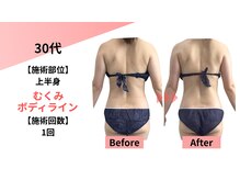 クレビア(Clevia)/Clevia-クレビア