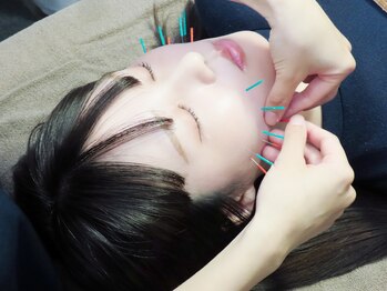 オードヴィー整骨院/人気美容鍼【くすみ/肌質改善】