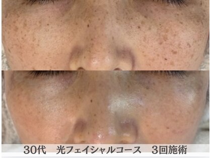 アリィ エステティック(allie esthetic)の写真