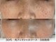 アリィ エステティック(allie esthetic)の写真