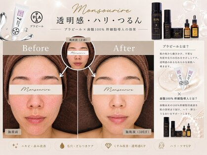 モンスリール 麻布十番(Mon Sourire)の写真