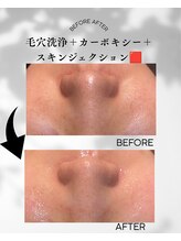 ケーナインエッセ(K9 esse)/エステ版ポテンツァ