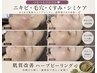 １日で叶える、本格ハーブトリートメント通常38,500円 → 初回22,000円