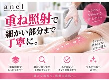 アネル 新都心店(anel)