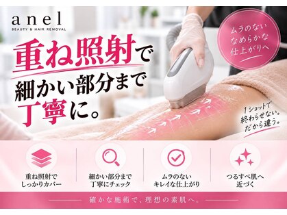 アネル 新都心店(anel)の写真