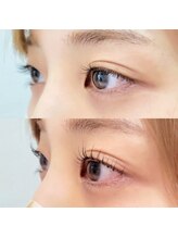 アイラッシュサロン モッペル(Eyelash Salon Moppel)/どこから見ても可愛い目元に♪