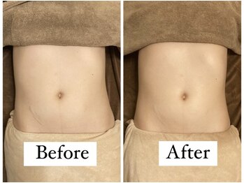 フルールドソレイユ(Fleur de Soleil)/腸のねじれ歪みも整う☆