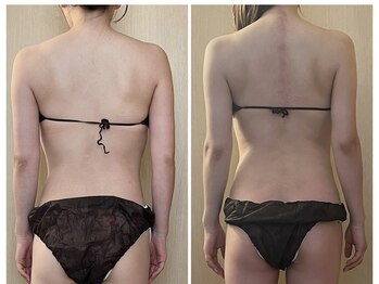 マイティー整骨院 ココア(CoCoa)/活性リンパ洗浄