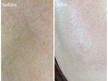 リジョーナ 岐南店(Lijona)/