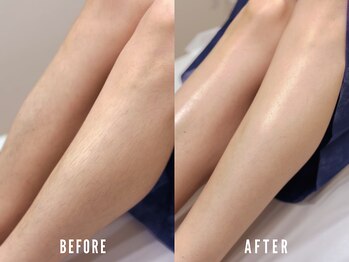 ビーグラム(B.GLAM)/シュガーリング／脚