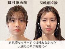 サロンキャン(Salon.CAN)/Ｖ字小顔に！本格改善コース