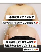 レアティ(Leathy)/上半身痩身集中ケア