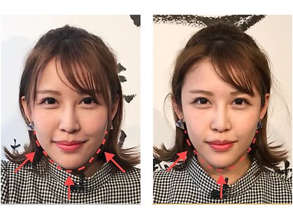 アキュモ整体ラボの写真