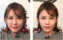 アキュモ整体ラボ