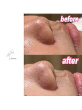 パンジー 上野フェイシャルエステ専門店(pansy)/*フェイシャル/ニキビケア*