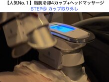 シアラ(SHIARA)/35分で取り外します