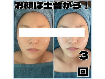 アンドワイ バイ サロンリーナ(&y by Salon Lena)/【コルギを超えたコルゾウ】