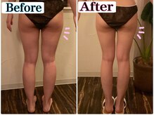 トータルビューティーサロン 凛/細身のパンツをはきこなす